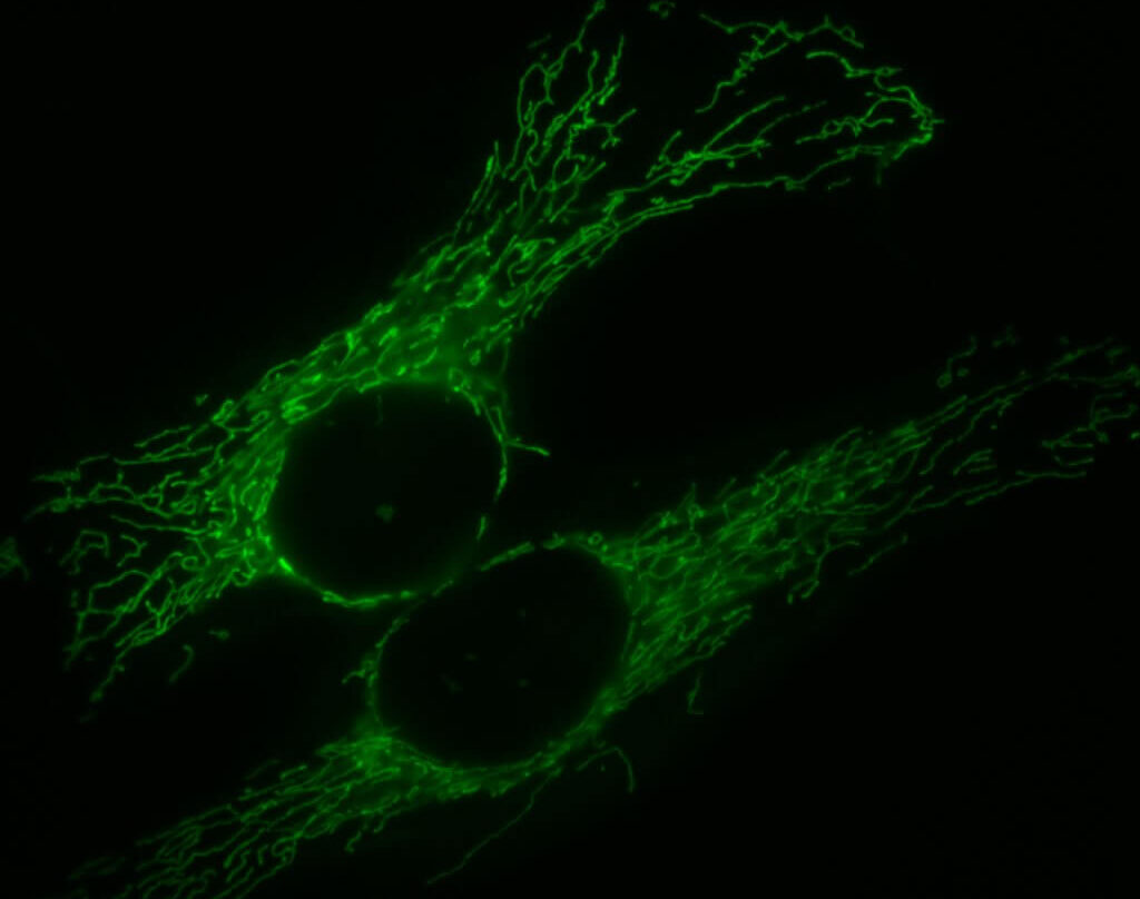 Simon Troeder. Fluorescent microscopy picture of HeLa cells expressing a mitochondrially targeted version of green fluorescent protein (mtGFP)
